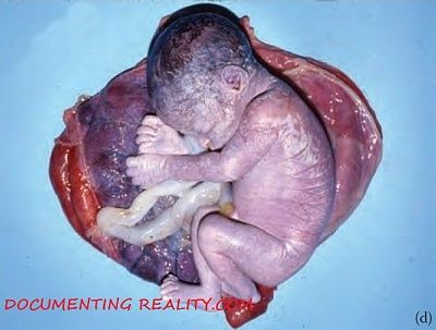 pregnant-mum3.jpg