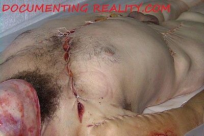 bodybag5.jpg