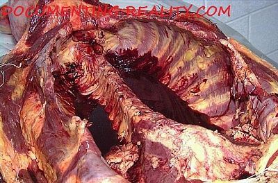 bodybag8.jpg