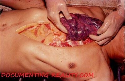thailand-autopsy1.jpg