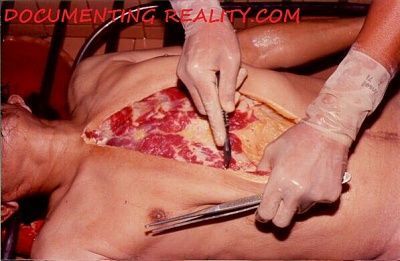 thailand-autopsy2.jpg