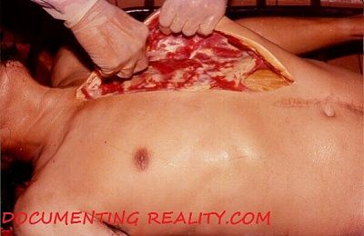 thailand-autopsy3.jpg