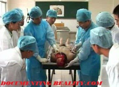 autopsy.jpg