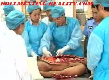 autopsy1.jpg