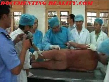 autopsy2.jpg