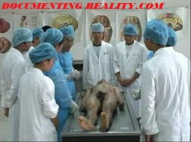 autopsy3.jpg