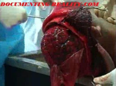 autopsy4.jpg