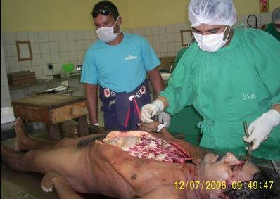 autopsy-photos-007.jpg