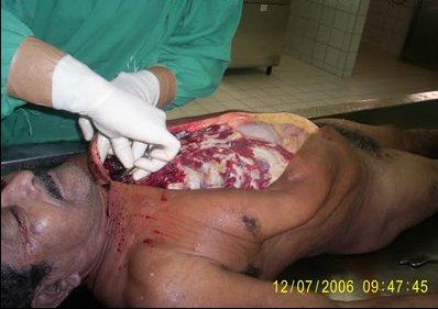 autopsy-photos-010.jpg