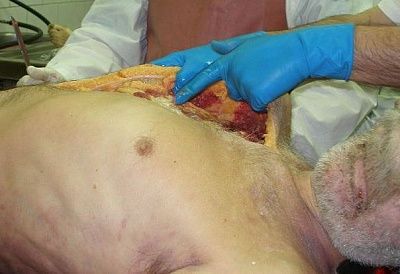 morgue1.jpg