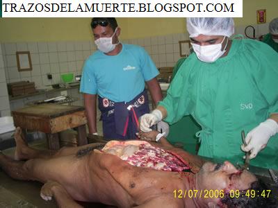Autopsia-4.jpg