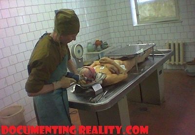 russianautopsy01.jpg