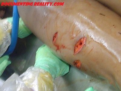 autopsy.jpg