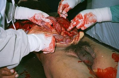 gastricgore-1-.jpg