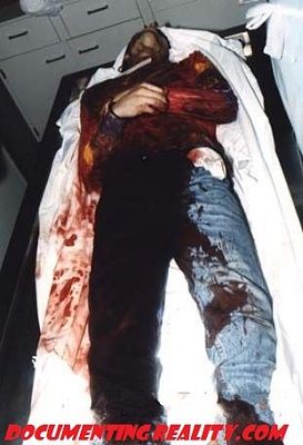bloody.jpg
