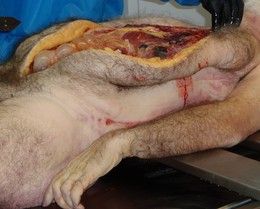 autopsy.jpg