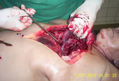 autopsy2.JPG