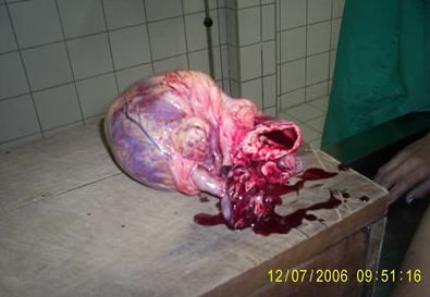autopsy3.JPG