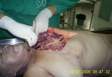 autopsy4.JPG