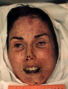 LisaMcPherson_Autopsy_six.jpg