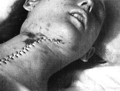 autopsy.jpg