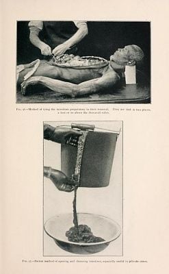 intestines.jpg