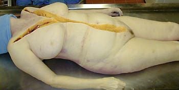 autopsy-20mixed-20-281-29.jpg