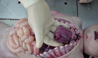 baby-boy-autopsy-01.jpg