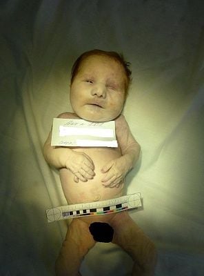 baby-autopsy-1.jpg