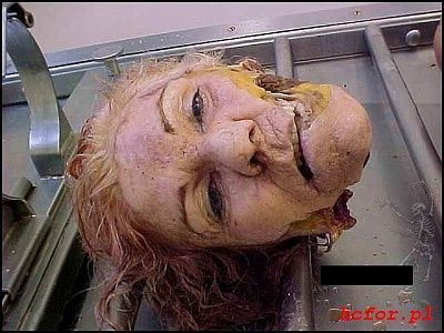 womans_head_autopsy_001.jpg