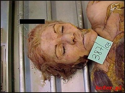 womans_head_autopsy_002.jpg
