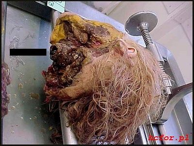 womans_head_autopsy_003.jpg