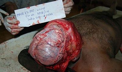 autopsy_of_murdered_man_1.jpg