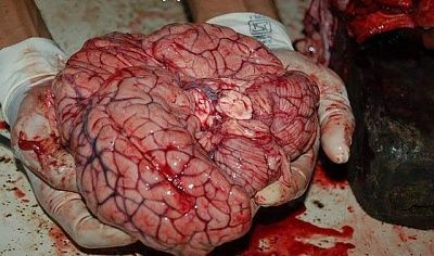 autopsy_of_murdered_man_3.jpg