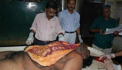 autopsy_of_murdered_man_5.jpg