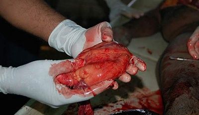 autopsy_of_murdered_man_6.jpg
