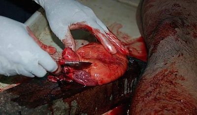 autopsy_of_murdered_man_7.jpg