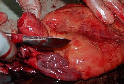 autopsy_of_murdered_man_8.jpg
