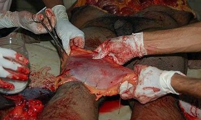 autopsy_of_murdered_man_9.jpg