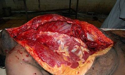 autopsy_of_murdered_man_10.jpg