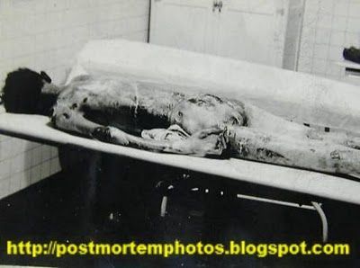 another_vintage_autopsy_photo-closeup-post.jpg