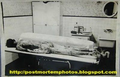 another_vintage_autopsy_photo-POST.jpg