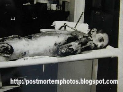 autopsy_post_mortem_1930s_man_0200.jpg