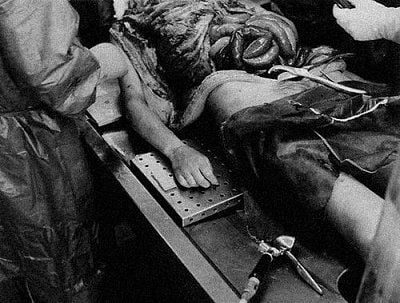 autopsy-picture-2.jpg