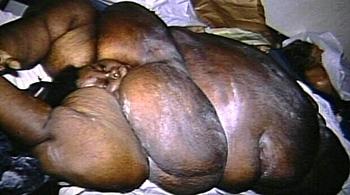 obese1.jpeg