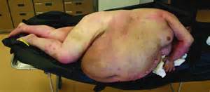 obese7.jpg