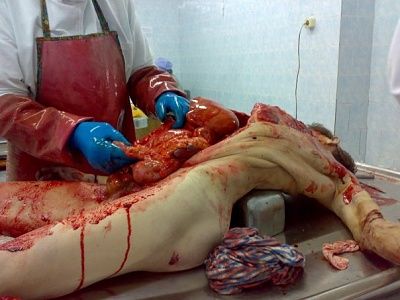 autopsy-5-.jpg