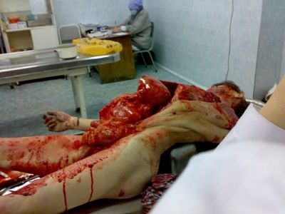 autopsy-4-.jpg