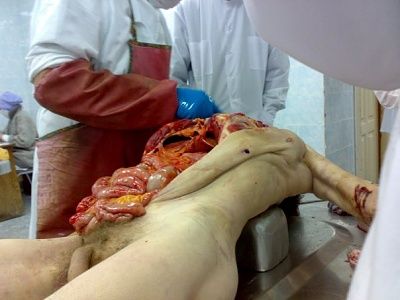 autopsy-6-.jpg