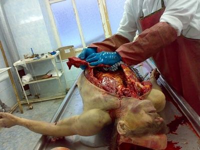 autopsy-9-.jpg